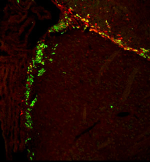 neurogenesis in adult forebrain